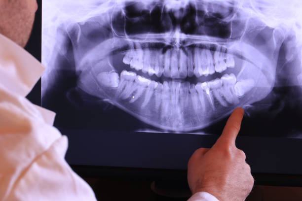 Best Emergency Dental Care for Broken or Chipped Teeth in West Bishop, CA