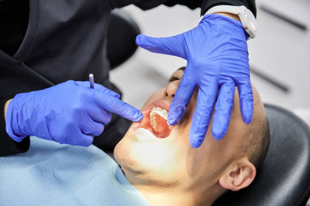 Best After-Hours Dental Trauma Care in West Bishop, CA
